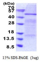 Human ELP4 Protein (Recombinant His)