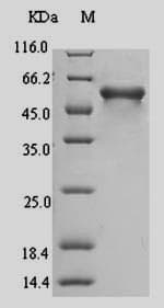 Mouse MAdCAM-1 Protein (Recombinant 6His-SUMO, N-terminus)