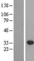 SIX2 Protein (Over-Expression Lysate Myc-DDK (Flag))