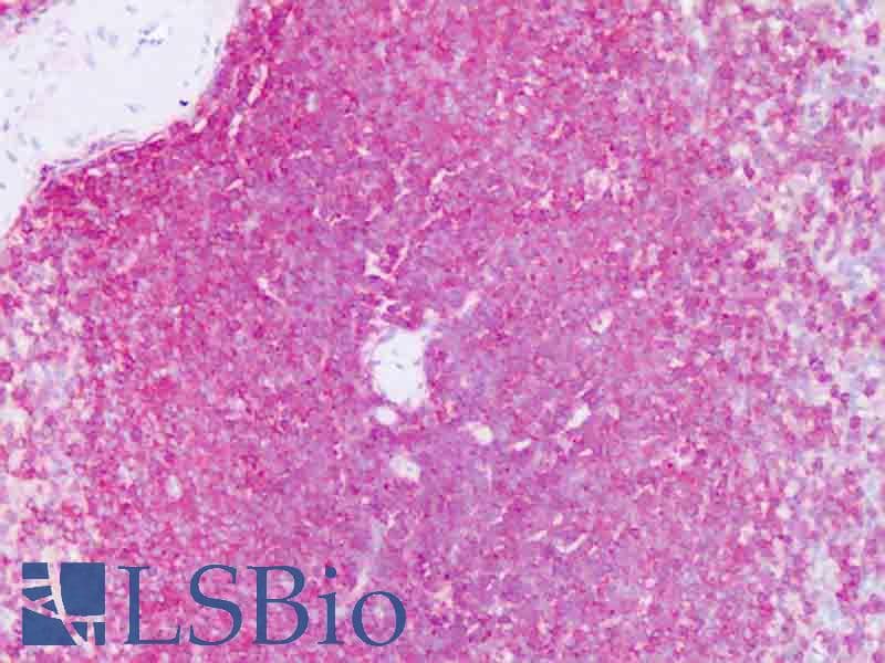 IHC-plus™ CD45 / LCA Antibody (clone YTH24.5)