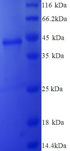 Human Endostatin Protein (Recombinant His)