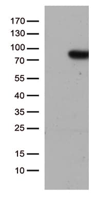 Monoclonal Mouse anti-Human SLU7 / 9G8 Antibody (clone OTI5A7, aa1-300, IHC, WB)