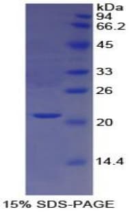 Human CTSL / Cathepsin L Protein (Recombinant His, N-Terminal)