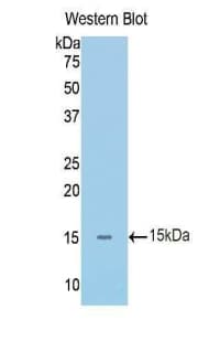 IL1R1 Antibody (aa119-217, APC)