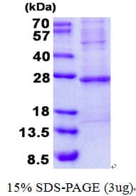 Human TNNI2 Protein (Recombinant His)