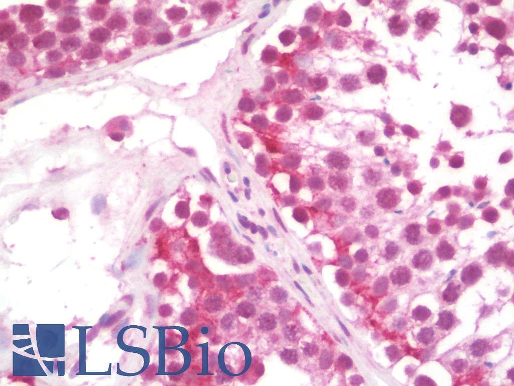 TLX3 Antibody