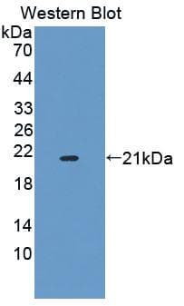 DMPK / DM Antibody (PE)