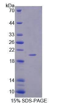 Rat IL1F9 Protein (Recombinant His-T7)