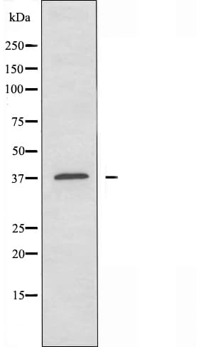 Polyclonal Rabbit anti-Human EIF3S5 / EIF3F Antibody (IHC, IF, WB)