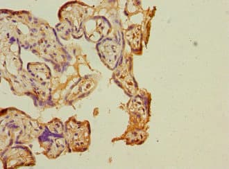 COPB2 / Beta-COP Antibody