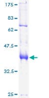 Human FOXP1 Protein (Recombinant GST)