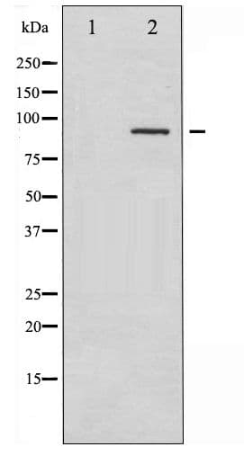 SYK Antibody (phospho-Tyr323)