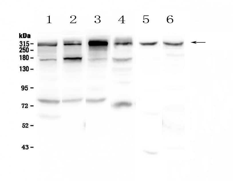 IGF2R / CD222 Antibody