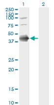 FCER2 / CD23 Antibody (clone S52)