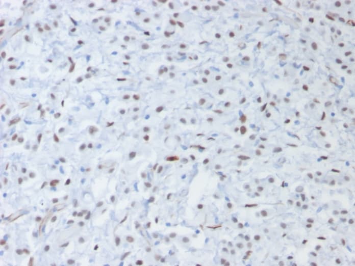 Recombinant Monoclonal Mouse anti-Human WT1 / Wilms Tumor 1 Antibody (clone rWT1/857, Azide-free,Carrier-free, IHC)
