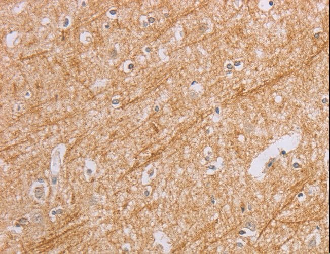 Polyclonal Rabbit anti-Human Osteocalcin Antibody (IHC)