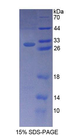 Human BCL10 / BCL-10 Protein (Recombinant His-T7)