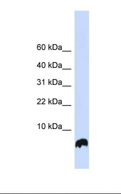 GLRX / Glutaredoxin Antibody (aa38-87)