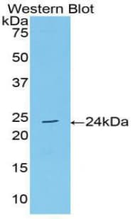 ACHE / Acetylcholinesterase Antibody (aa377-574, PE)