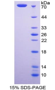 Human FBLN4 / EFEMP2 Protein (Recombinant His-GST)