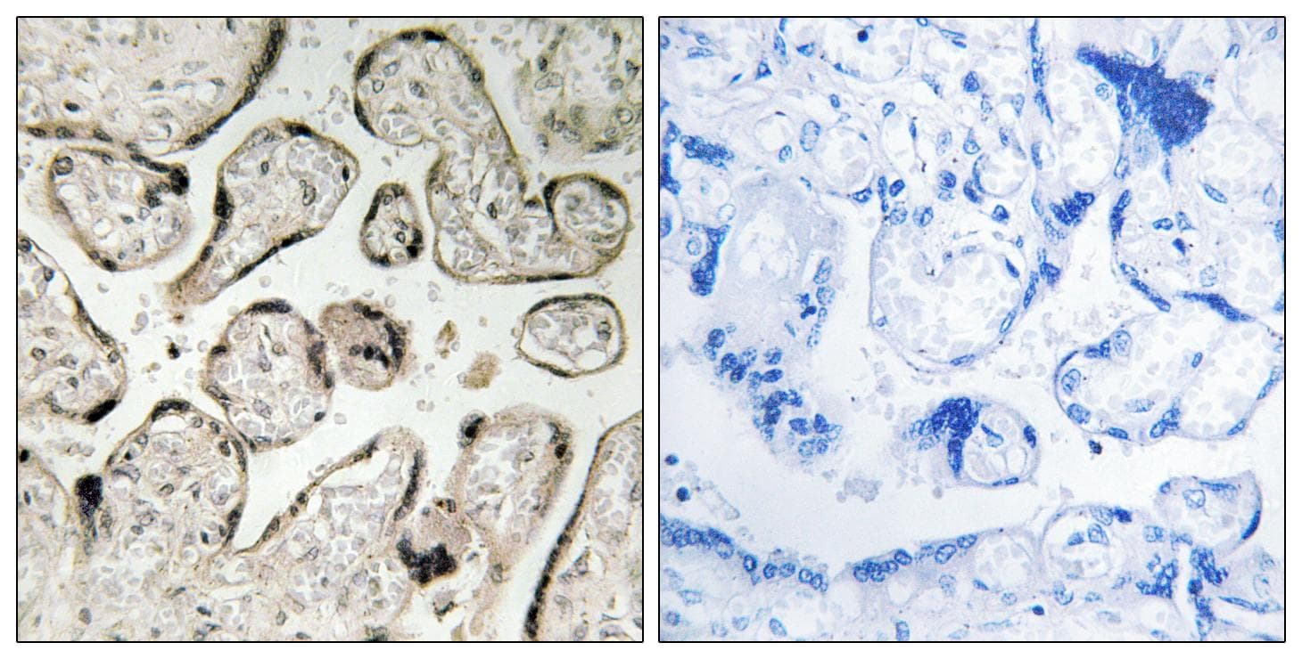 Polyclonal Rabbit anti-Human GIMAP5 Antibody (IHC, WB)