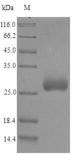 Chlamydia trachomatis omcA Protein (Recombinant 6His-SUMO, N-terminus)