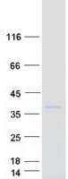 Human CD66d / CEACAM3 Protein (Recombinant Myc-DDK (Flag))