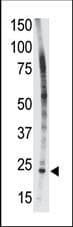 BID Antibody (aa68-103)