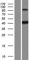 ZDHHC20 Protein (Over-Expression Lysate Myc-DDK (Flag))