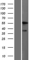 Human ALDH9A1 Protein (Over-Expression Lysate Myc-DDK (Flag))