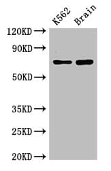 SLU7 / 9G8 Antibody