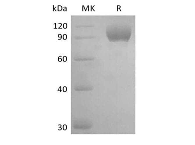 Mouse AXL Protein (Recombinant Fc, C-terminus)