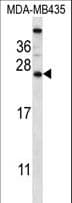 Polyclonal Rabbit anti-Human CABP5 Antibody (aa3-32, WB)
