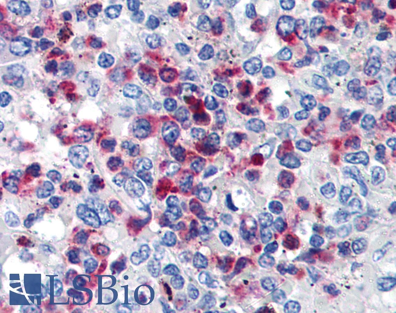 PathPlus™ CD63 Antibody (clone MEM-259)