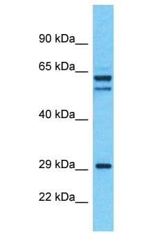 ALS2CL Antibody (aa333-382)