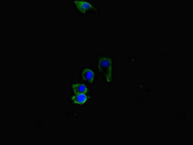 Polyclonal Rabbit anti-Human ACVRL1 Antibody (IF, WB)