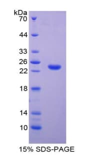 Bovine TIMP4 Protein (Recombinant His-T7)