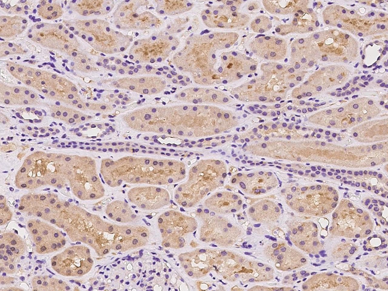 CCDC67 Antibody