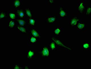 Polyclonal Rabbit anti-Human DHX36 Antibody (IF)