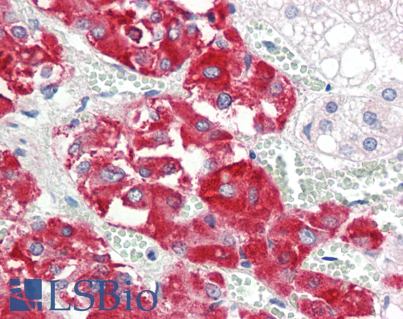IHC-plus™ EPS8L2 Antibody (aa1-50)