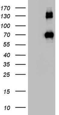 Monoclonal Mouse anti-Human CD68 Antibody (clone OTI6C3, aa22-319, WB)