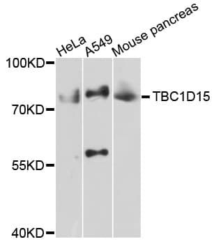 TBC1D15 Antibody