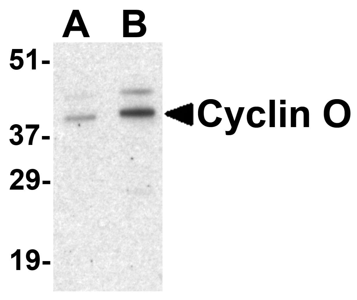 Polyclonal Rabbit anti-Human CCNO / UNG2 Antibody (WB)