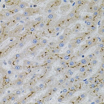 Polyclonal Rabbit anti-Human MAPK1 / ERK2 Antibody (IHC, WB)