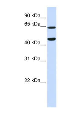 TRIM54 / MURF Antibody (N-Terminus)