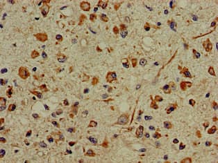 PFAS Antibody