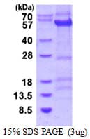 Human CCNB1 / Cyclin B1 Protein (Recombinant His)