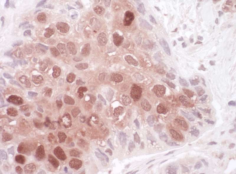 Polyclonal Rabbit anti-Human SQSTM1 Antibody (aa375-425, IHC, WB)