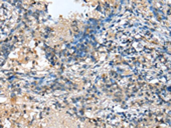 Polyclonal Rabbit anti-Human MOB4 / PHOCN Antibody (IHC, WB)