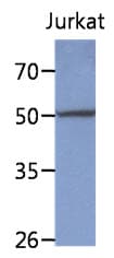 PPM1F Antibody (clone AT6D11)